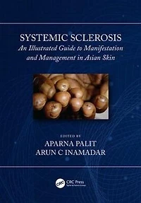 Systemic Sclerosis: An Illustrated Guide to Manifestation and Management Asian Skin