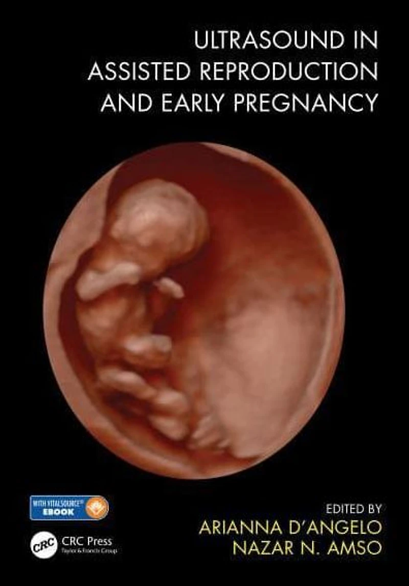Ultrasound Assisted Reproduction and Early Pregnancy