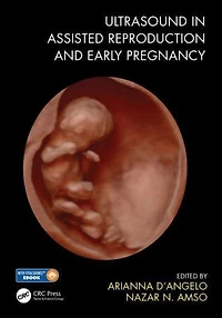 Ultrasound Assisted Reproduction and Early Pregnancy
