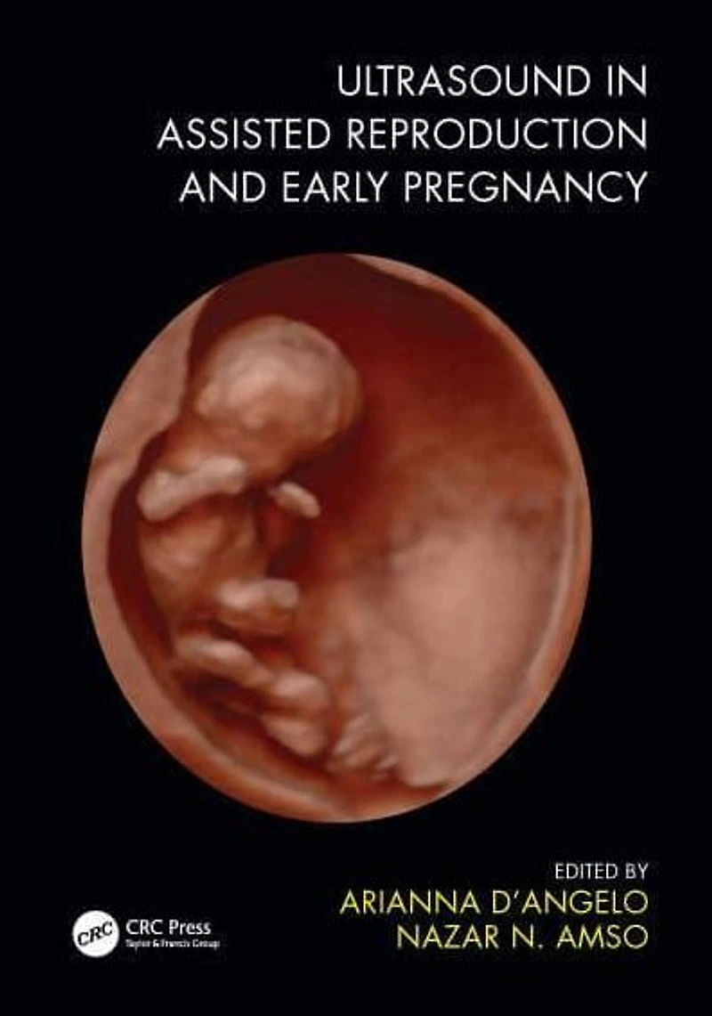 Ultrasound Assisted Reproduction and Early Pregnancy