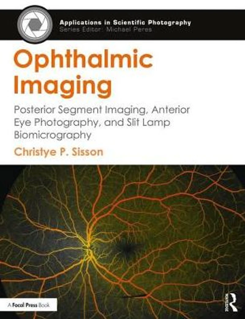 Ophthalmic Imaging: Posterior Segment Imaging, Anterior Eye Photography, and Slit Lamp Biomicrography