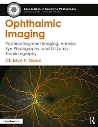 Ophthalmic Imaging: Posterior Segment Imaging, Anterior Eye Photography, and Slit Lamp Biomicrography