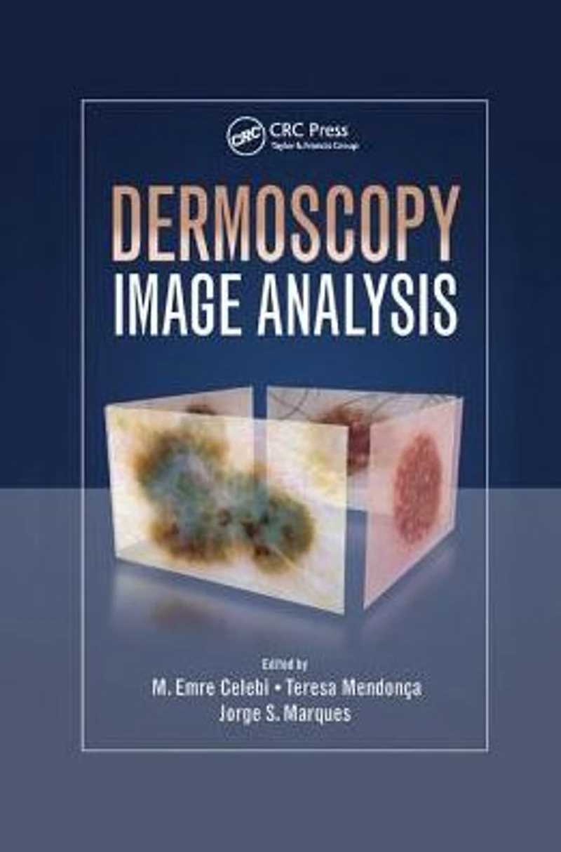 Dermoscopy Image Analysis