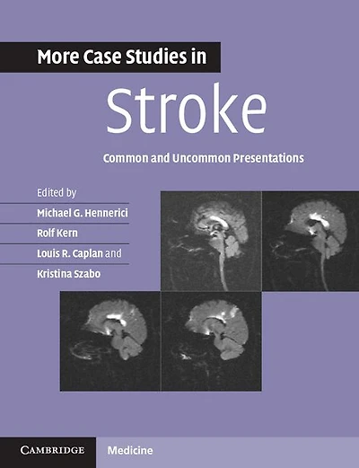 More Case Studies Stroke: Common and Uncommon Presentations