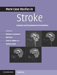 More Case Studies Stroke: Common and Uncommon Presentations