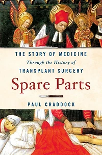 Spare Parts: the Story of Medicine Through History Transplant Surgery