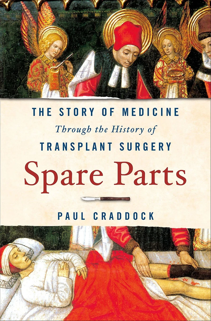 Spare Parts: the Story of Medicine Through History Transplant Surgery