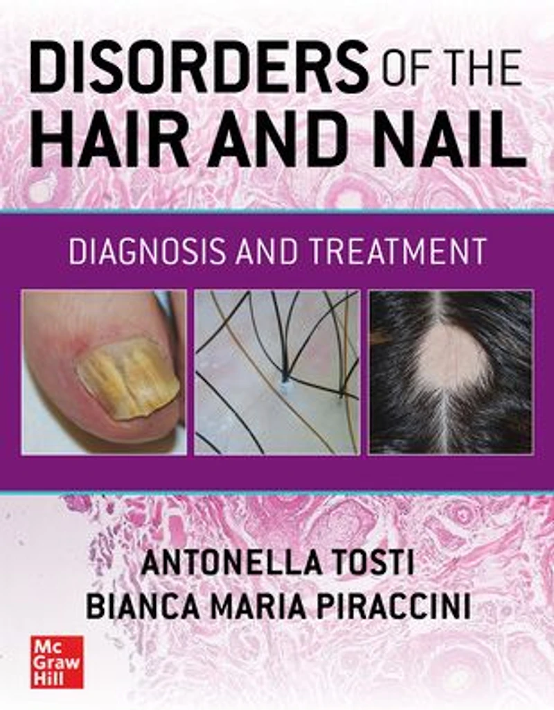 Disorders of the Hair and Nail: Diagnosis Treatment