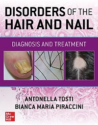 Disorders of the Hair and Nail: Diagnosis Treatment
