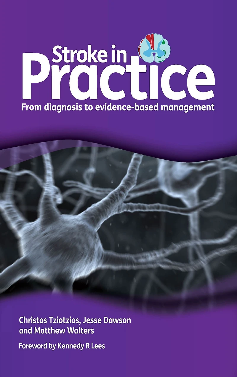 Stroke Practice: From Diagnosis to Evidence-Based Management