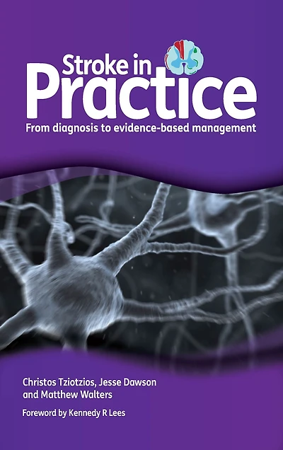Stroke Practice: From Diagnosis to Evidence-Based Management
