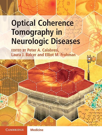 Optical Coherence Tomography Neurologic Diseases