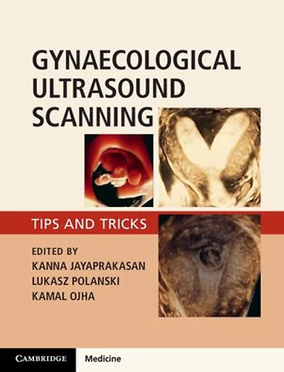 Gynaecological Ultrasound Scanning: Tips and Tricks