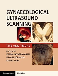 Gynaecological Ultrasound Scanning: Tips and Tricks