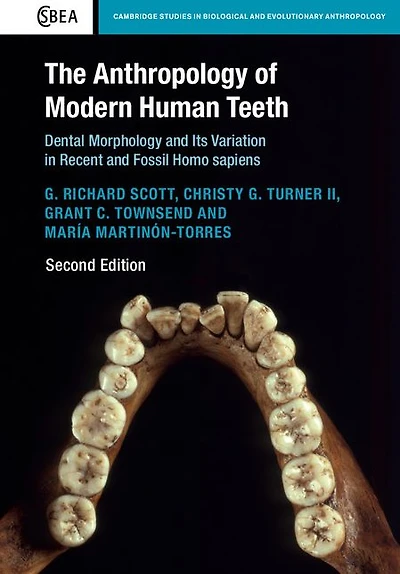 The Anthropology of Modern Human Teeth: Dental Morphology and its Variation Recent Fossil Homo sapiens