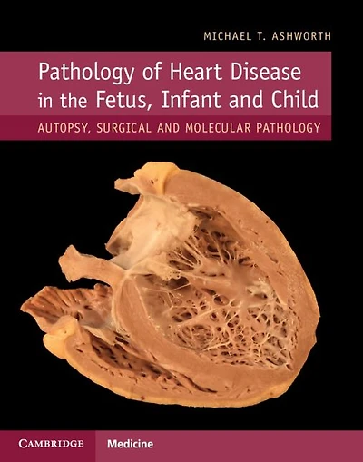 Pathology of Heart Disease the Fetus, Infant and Child: Autopsy, Surgical Molecular