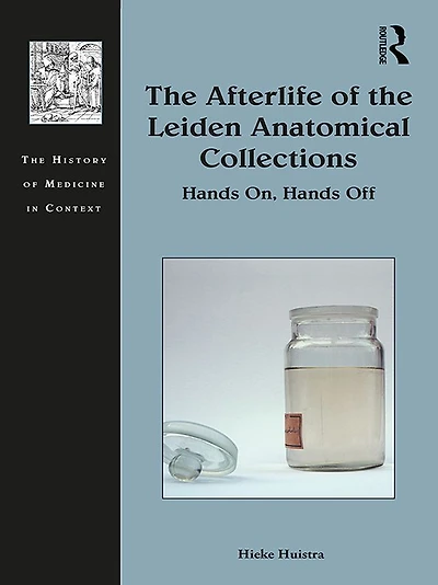the Afterlife of Leiden Anatomical Collections: Hands On, Off