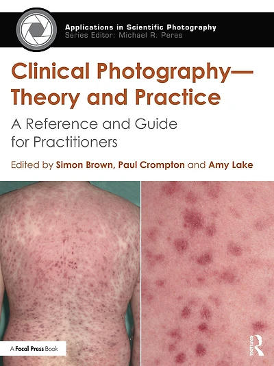 Clinical Photography - Theory and Practice: A Reference Guide for Practitioners