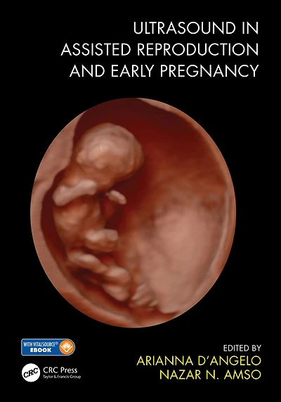 Ultrasound Assisted Reproduction and Early Pregnancy
