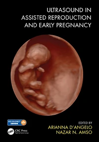 Ultrasound Assisted Reproduction and Early Pregnancy