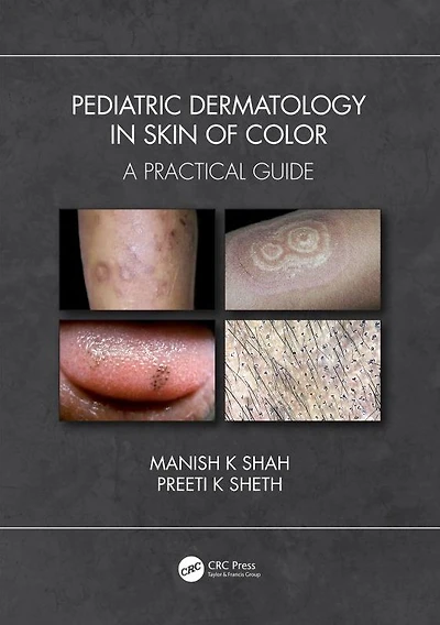 Pediatric Dermatology Skin of Color: A Practical Guide