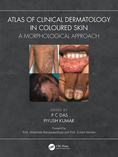 Atlas of Clinical Dermatology Coloured Skin: A Morphological Approach