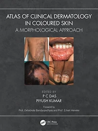 Atlas of Clinical Dermatology Coloured Skin: A Morphological Approach