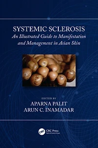 Systemic Sclerosis: An Illustrated Guide to Manifestation and Management Asian Skin