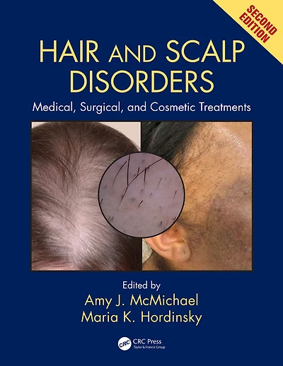 Hair and Scalp Disorders: Medical, Surgical, Cosmetic Treatments, Second Edition