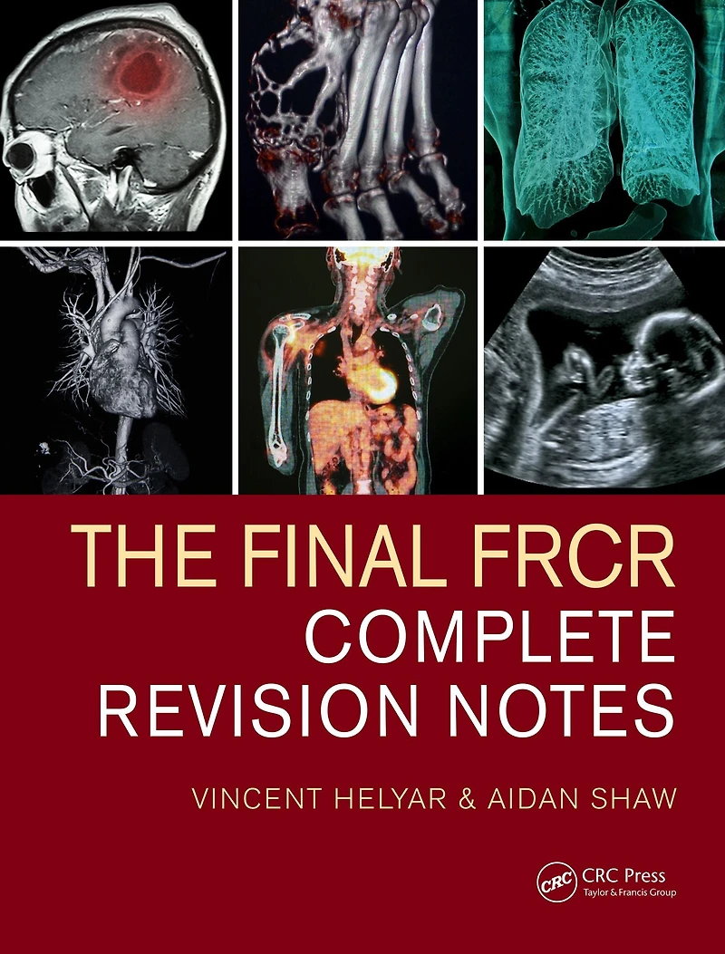 The Final FRCR: Complete Revision Notes