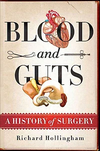 Blood and Guts: A History of Surgery