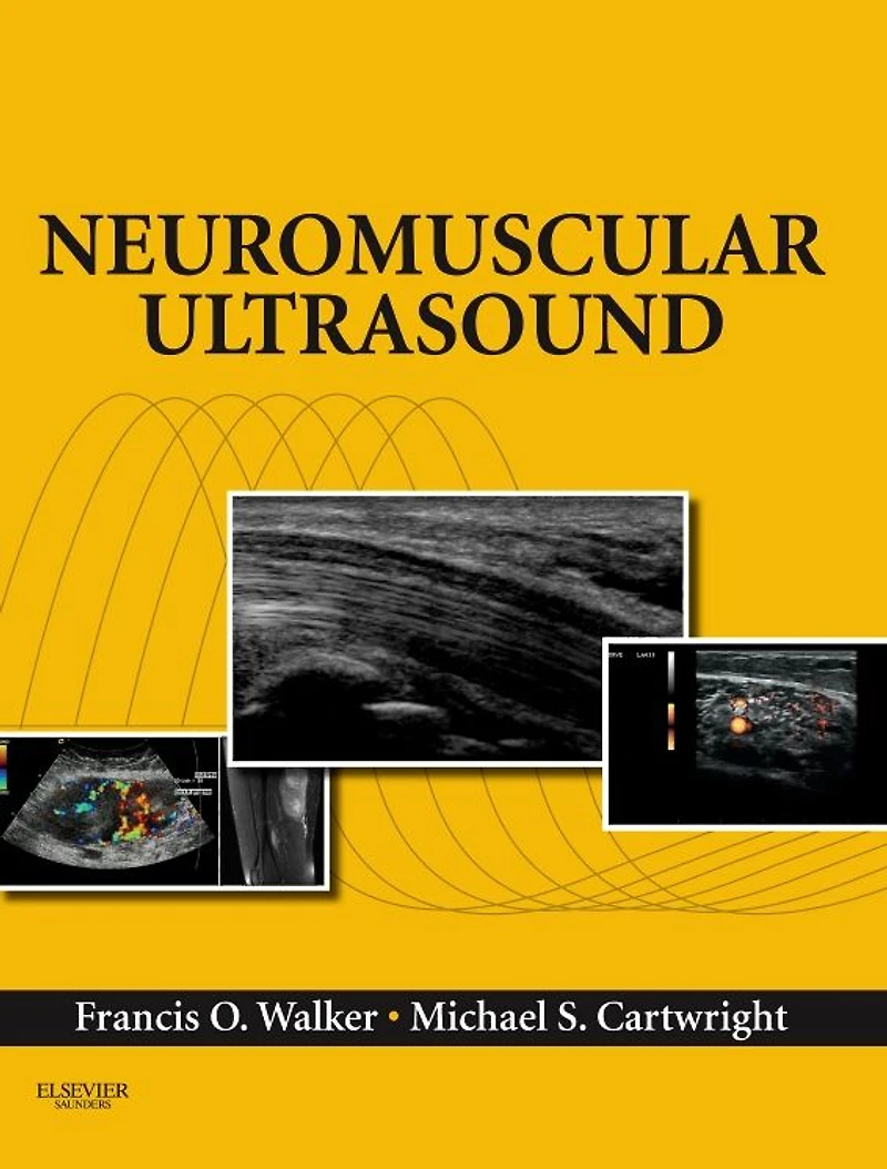 Neuromuscular Ultrasound E-Book: Expert Consult - Online and Print