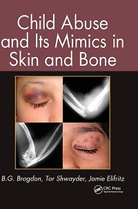 Child Abuse and its Mimics Skin Bone