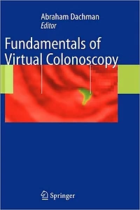 Fundamentals of Virtual Colonoscopy