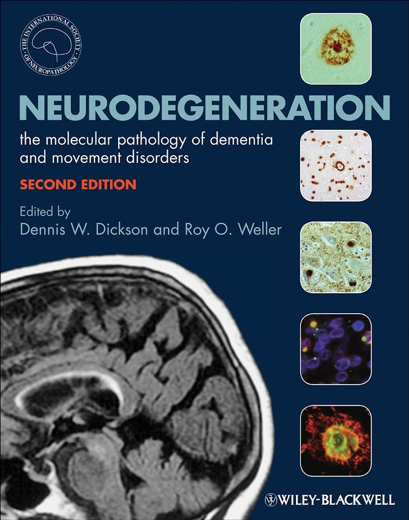 Neurodegeneration: The Molecular Pathology of Dementia and Movement Disorders