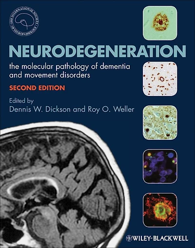 Neurodegeneration: The Molecular Pathology of Dementia and Movement Disorders