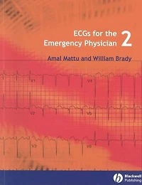 ECGs for the Emergency Physician 2