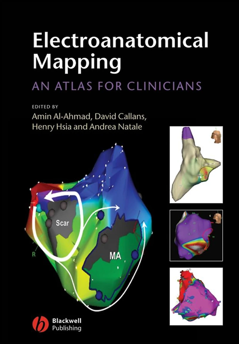 Electroanatomical Mapping: An Atlas for Clinicians
