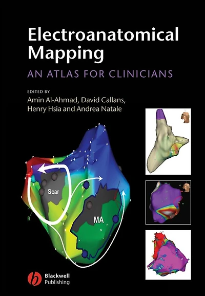 Electroanatomical Mapping: An Atlas for Clinicians