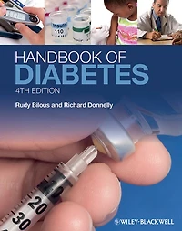 Handbook of Diabetes