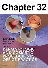 Dermoscopy: Chapter 32 of Dermatologic and Cosmetic Procedures in Office Practice