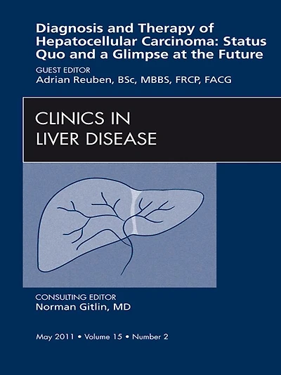 Hepatocellular Carcinoma, An Issue of Clinics in Liver Disease: Hepatocellular Carcinoma, An Issue of Clinics in Liver Disease