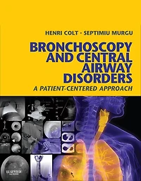 Bronchoscopy and Central Airway Disorders E-Book: A Patient-Centered Approach: Expert Consult Online