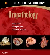 Uropathology E-Book: A Volume in the High Yield Pathology Series