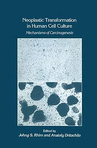 Neoplastic Transformation Human Cell Culture: Mechanisms of Carcinogenesis