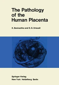 The Pathology of the Human Placenta
