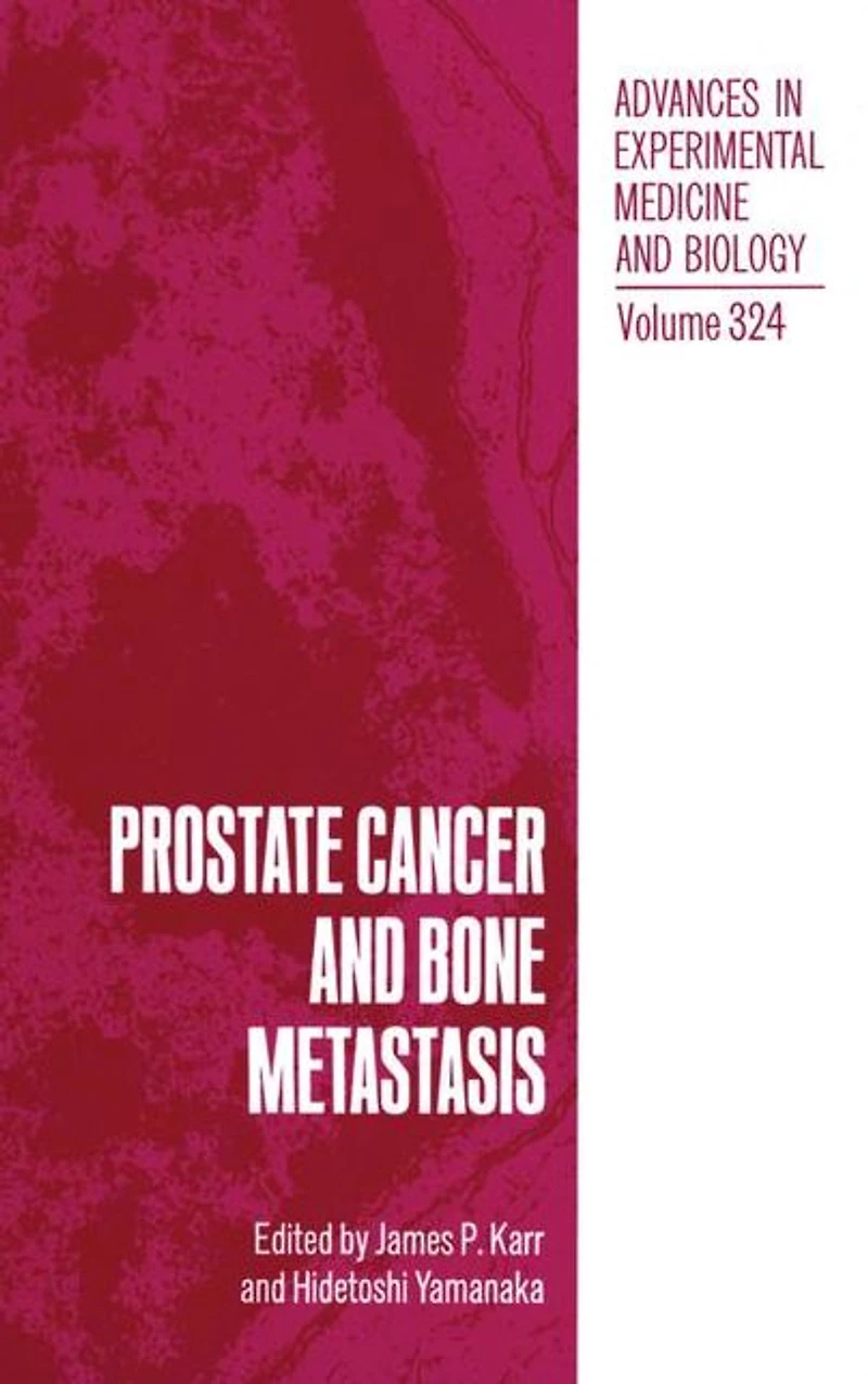 Prostate Cancer and Bone Metastasis