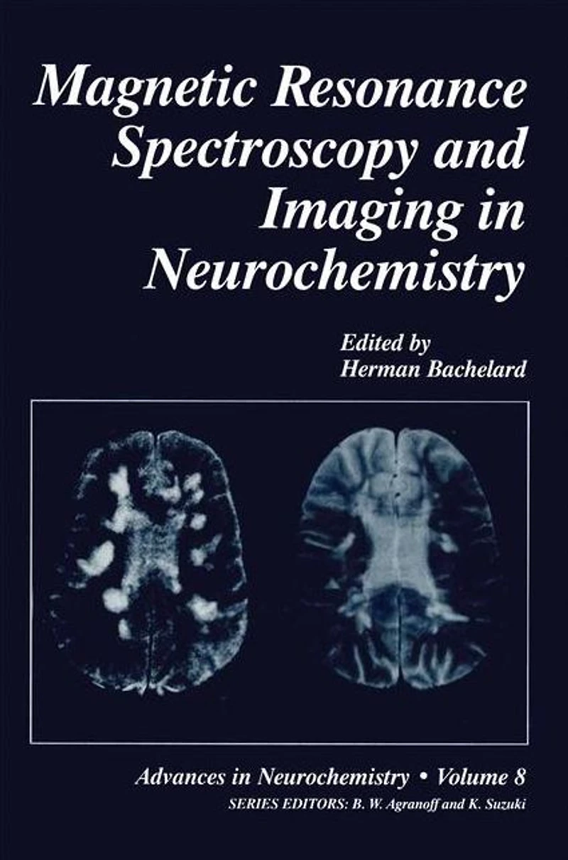 Magnetic Resonance Spectroscopy and Imaging Neurochemistry