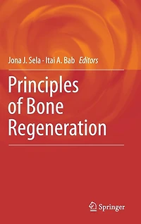 Principles of Bone Regeneration