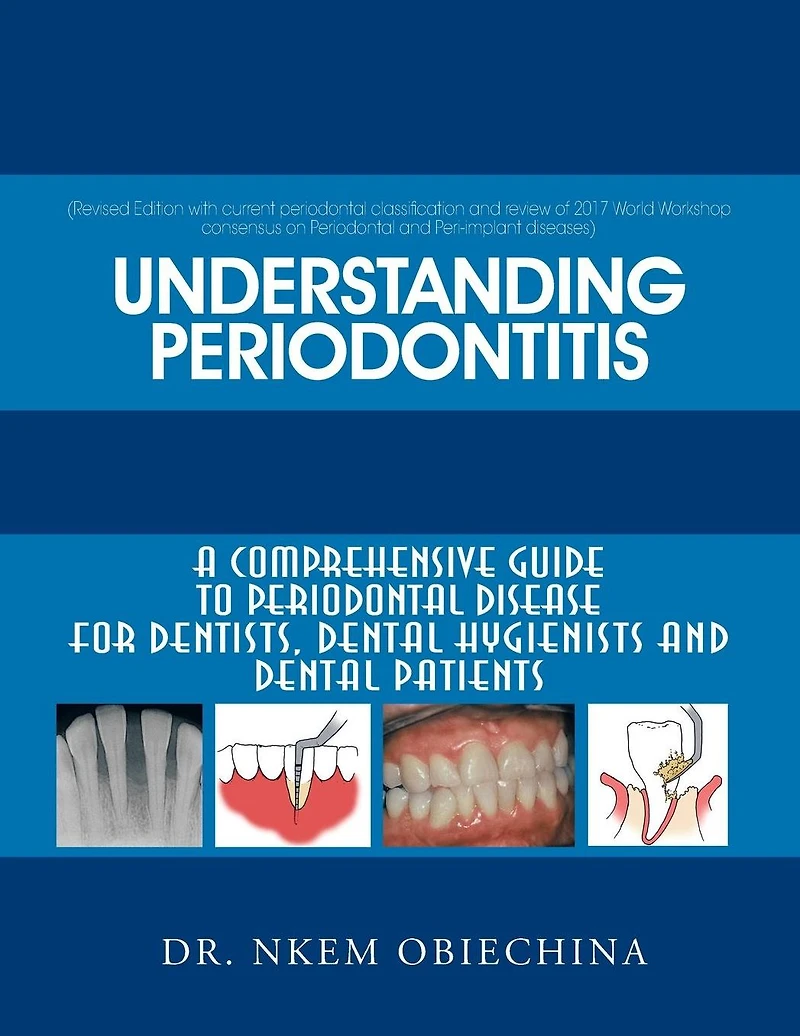 Understanding Periodontitis: A Comprehensive Guide to Periodontal Disease for Dentists, Dental Hygienists and Patients